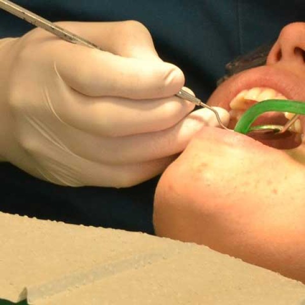 Waarvoor is een tandongevallenverzekering?